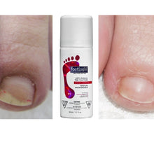 Footlogix Toe Nail Tincture Spray